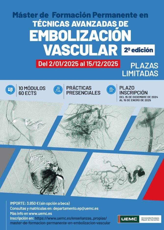 Máster de Formación Permanente en Técnicas Avanzadas de Embolización Vascular (2ª edición) ¡Plazas limitadas! 📅 Duración: Del 02/01 al 15/12/2025 📷 10 módulos | 60 ECTS | Prácticas presenciales 📷 Importe: 3.850 €💰