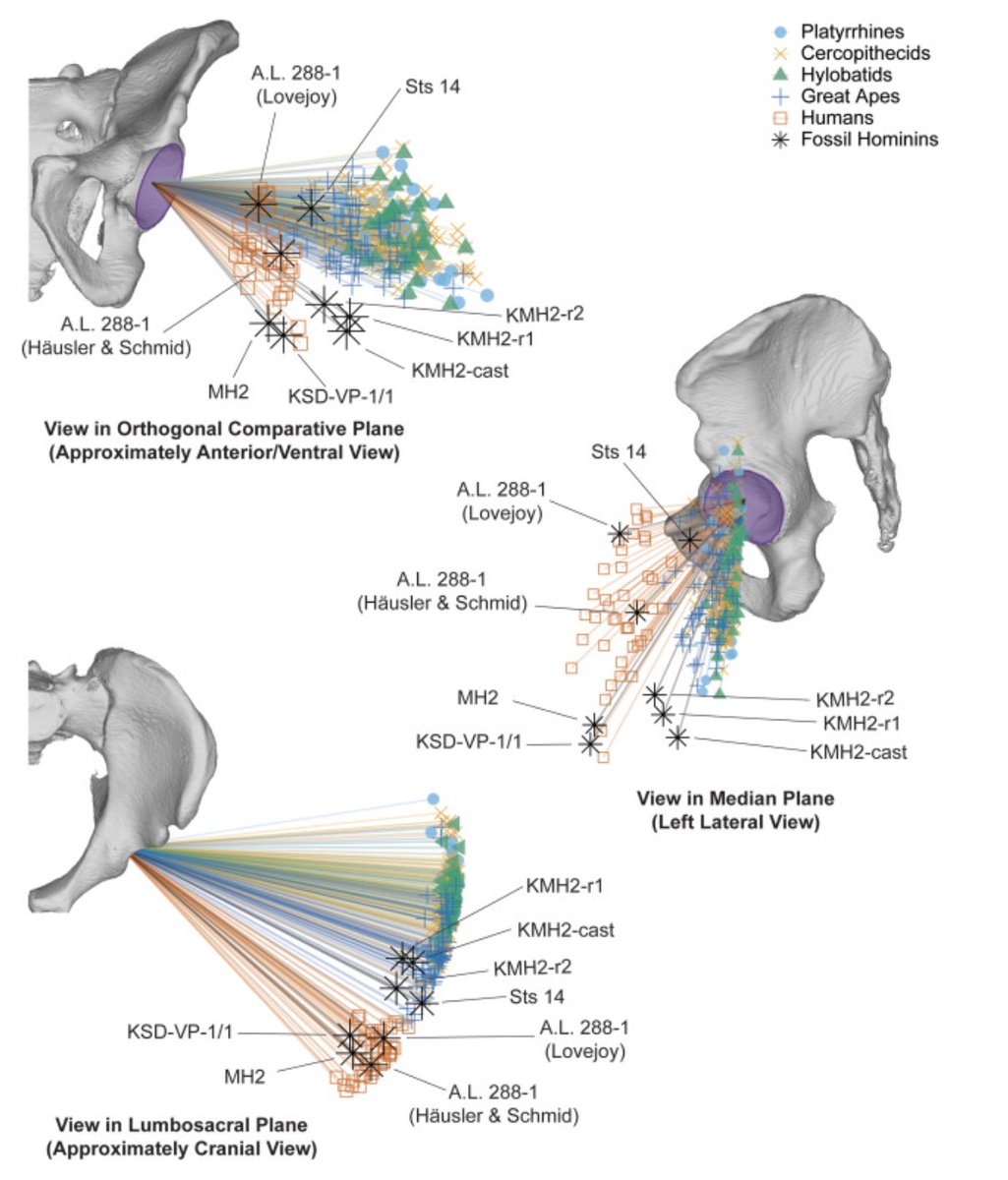 Ashley Hammond (@ashleyshammond) on Twitter photo The orientation of the hominin acetabulum was humanlike (ventrally-opening) by at least 3.6 Ma.
New paper on acetabular orientation in hominins, featuring killer work by my badass colleagues <a href="/Anthro_Austin/">Austin Lawrence</a> and <a href="/wardcv/">Carol Ward</a>
50 days' free access:
authors.elsevier.com/c/1kOeYAlZXXr~8 The orientation of the hominin acetabulum was humanlike (ventrally-opening) by at least 3.6 Ma.
New paper on acetabular orientation in hominins, featuring killer work by my badass colleagues <a href="/Anthro_Austin/">Austin Lawrence</a> and <a href="/wardcv/">Carol Ward</a>
50 days' free access:
authors.elsevier.com/c/1kOeYAlZXXr~8