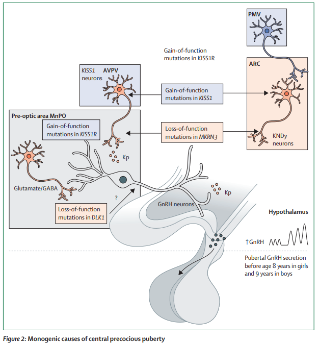 TheLancetEndo's tweet image. Molecular basis of normal and pathological #puberty: from basic mechanisms to clinical implications thelancet.com/journals/landi…  
#neuroendocrine #kisspeptins