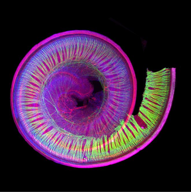 vita_pycode's tweet image. Spiral of #Sound by @RonPouyo . This picture showcases a #cochlea dissected and labeled by immunohistochemistry using a light sheet microscope. It reveals the spiral of hair cells responsible for converting sound waves into electronic signals that are sent to the #brain.