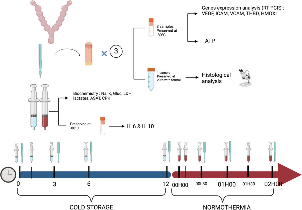 TransplantDirect (@txpdirect) on Twitter photo This study highlights its feasibility, showing improved graft preservation, lower resistance indexes, and better tissue oxygenation compared to static cold storage. #Transplantation #OpenAccess #freetoread #TXPforALL tinyurl.com/9mtbdyrb This study highlights its feasibility, showing improved graft preservation, lower resistance indexes, and better tissue oxygenation compared to static cold storage. #Transplantation #OpenAccess #freetoread #TXPforALL tinyurl.com/9mtbdyrb