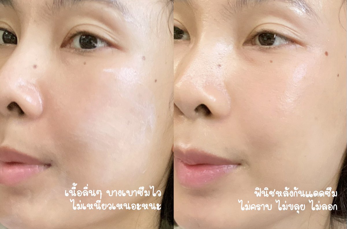 ใครที่เป็นสิวรักษาไม่หาย แกลองเปลี่ยนกันแดดดูก่อนนะ ช่วงก่อนนี้สิวอุดตันวนลูปเรื่อยๆ ลองมาใช้กันแดดพรีไบโอติก Cura-Md แล้วหน้ามันดีขึ้นเว้ย ไม่มีสิวอุดตันไตๆใต้ผิวแล้ว ยกเว้นรอบเดือนอาจมีอักเสบบ้าง แกร๊!!คือชอบเนื้อเค้าบางเบา หน้าไม่มันไม่เยิ้ม ที่สำคัญไม่อุดตัน สิวไม่เห่อ  ไม่เล่นคนเป็นสิวลองเปลี่ยนกันแดดดู บางตัวอาจทำให้ผิวอุดตัน หาที่ดีๆเหมาะกับผิวดู แนะนำตัวนี้คือกันแดดประเทศไทยถึง แล้วตอนทามันชุ่มชื้นนะ ผิวไม่ระคายเคืองเลยอะ เออ มันเริ่ด มันงงเลย ดี