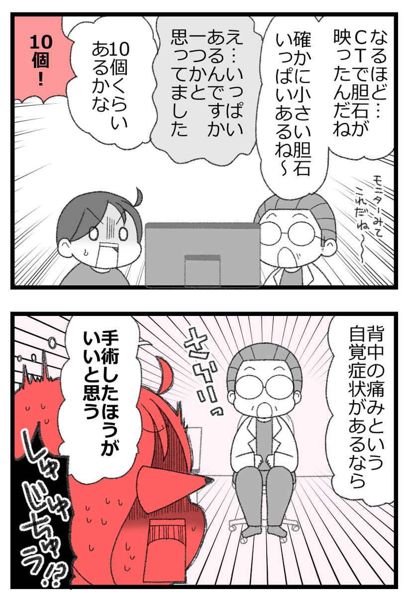 胆石で手術した話①3/4 
#漫画が読めるハッシュタグ 