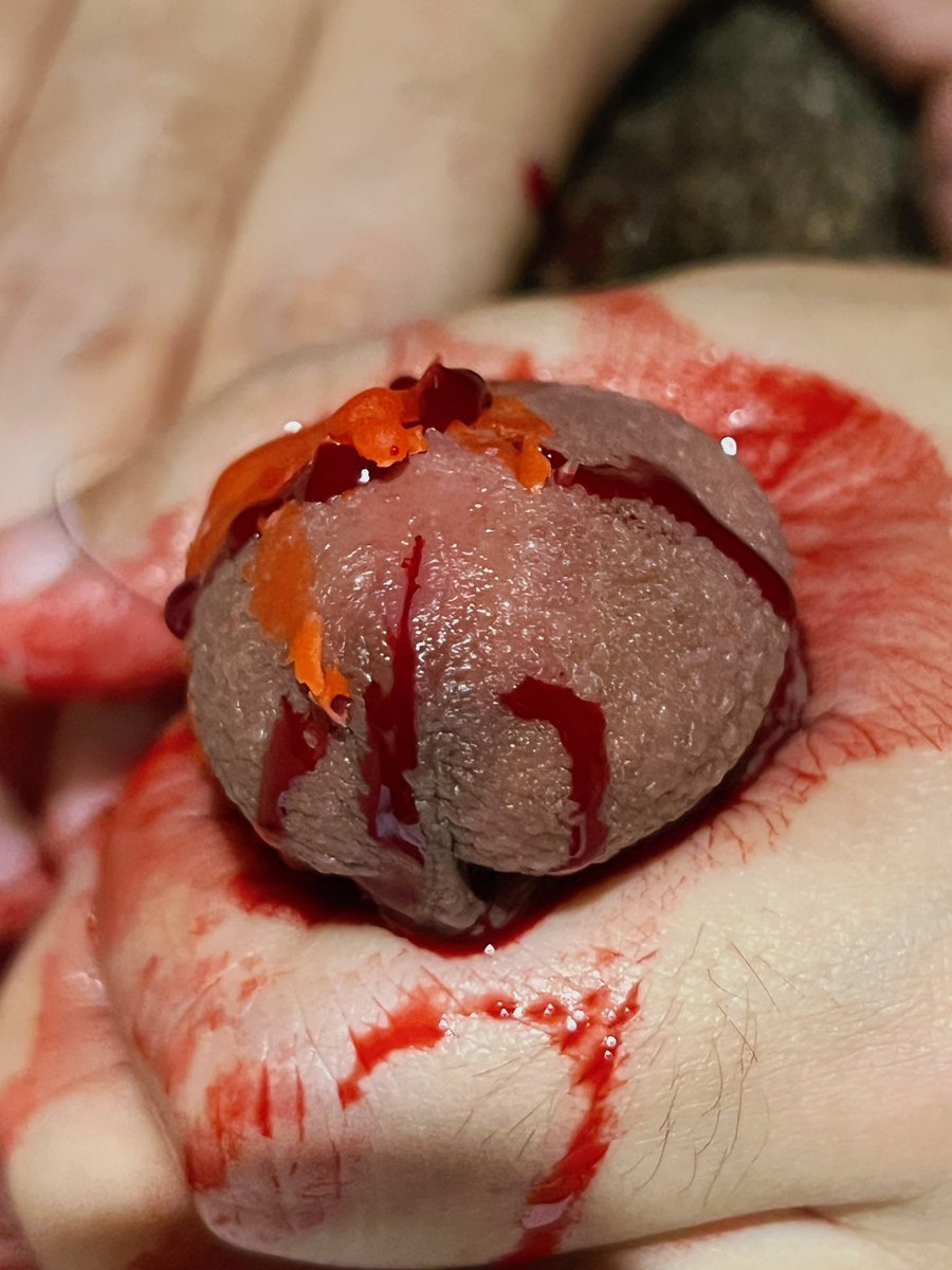 许愿 #穿刺 #虐阳 #男m #恋痛 #抗揍