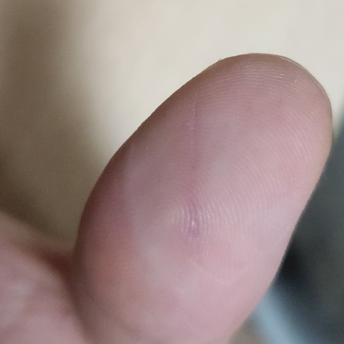 The wound healed faster than I thought, but I think I can draw this weekend instead of next week! 😉