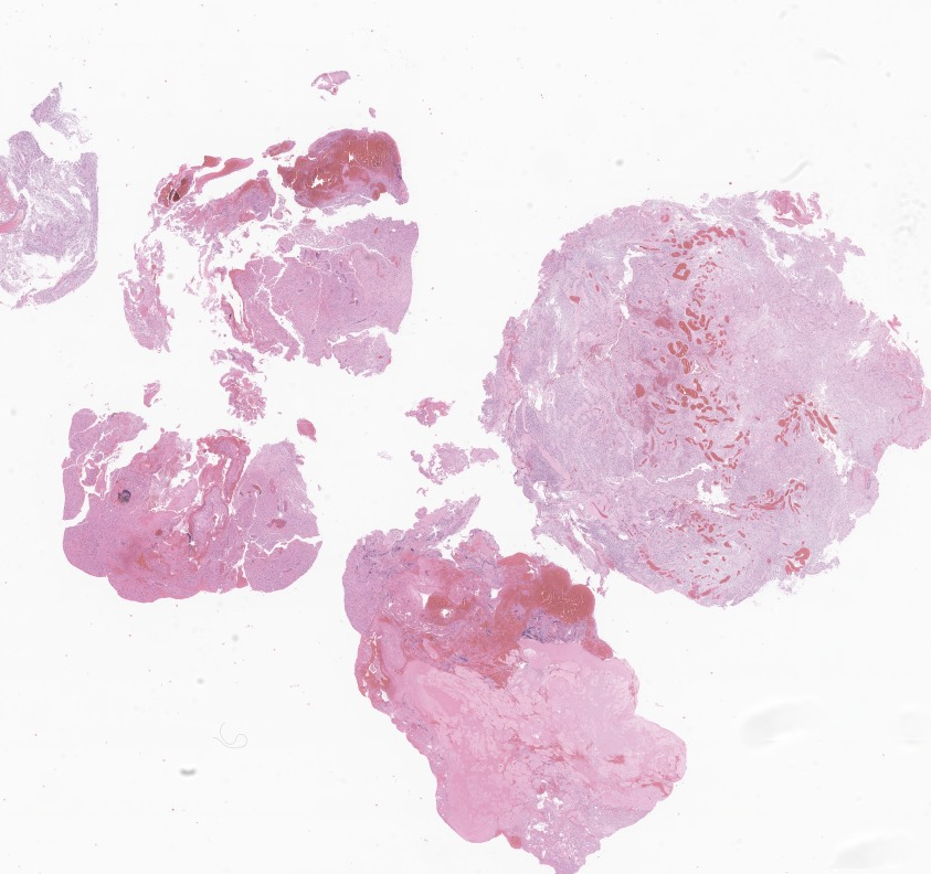 theNCI's tweet photo. New images available! NCI’s Imaging Data Commons now contains tumor and tissue images from nearly 2,000 children participating in the Molecular Characterization Initiative. Check it out! https://t.co/Kc0tRUC20d #Data4ChildhoodCancer #ChildhoodCancer #CancerResearch https://t.co/SChwNhpR5M
