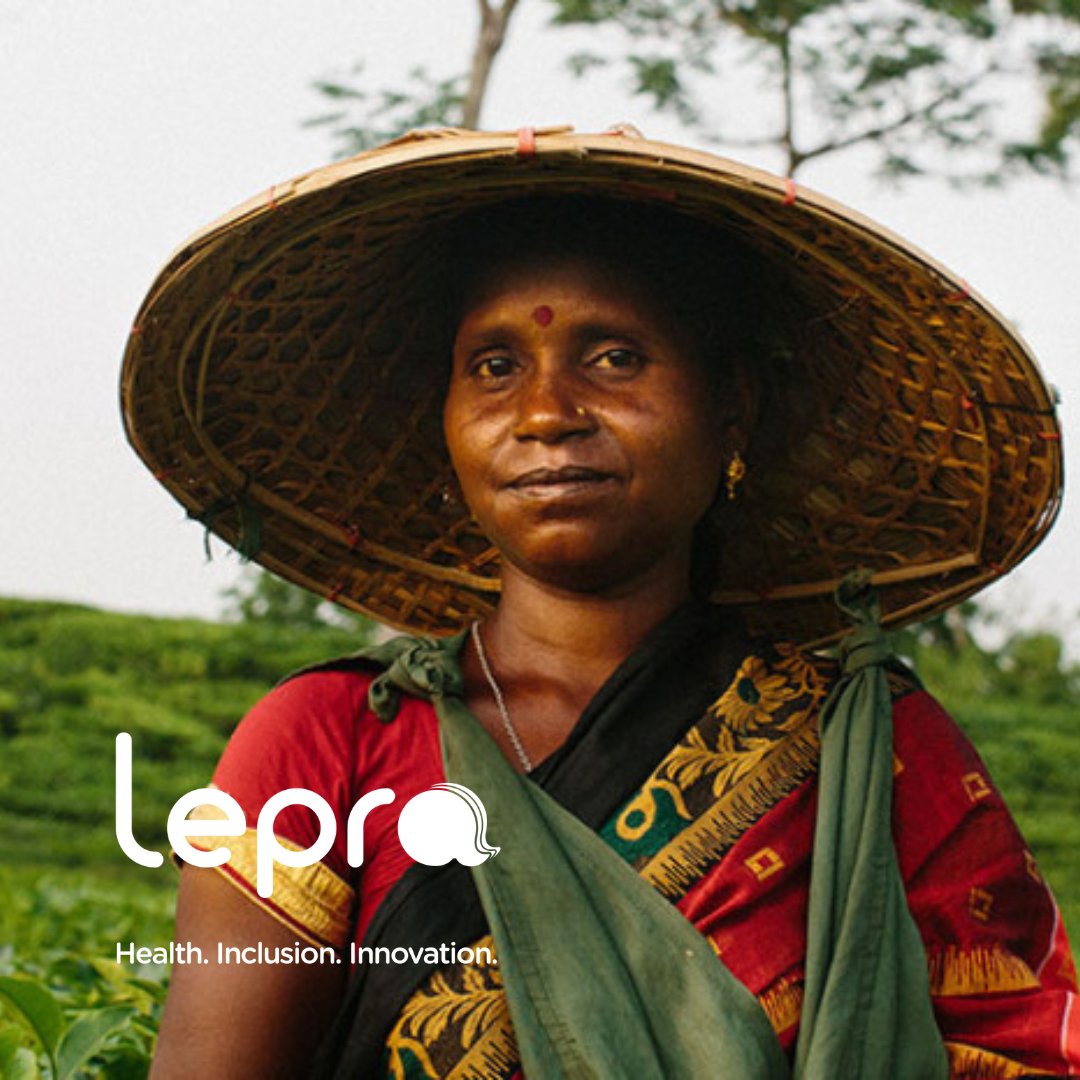 Lepra (@leprauk) on Twitter photo Lepra’s person-centred approach runs through every area of our work. Our holistic programmes aim to sustain positive wellbeing, lessening the impact of a diagnosis & providing better outcomes for recovery.
lepra.org.uk/what-we-do/per…
📷<a href="/tombradleyphoto/">Tom Bradley</a> Lepra’s person-centred approach runs through every area of our work. Our holistic programmes aim to sustain positive wellbeing, lessening the impact of a diagnosis & providing better outcomes for recovery.
lepra.org.uk/what-we-do/per…
📷<a href="/tombradleyphoto/">Tom Bradley</a>