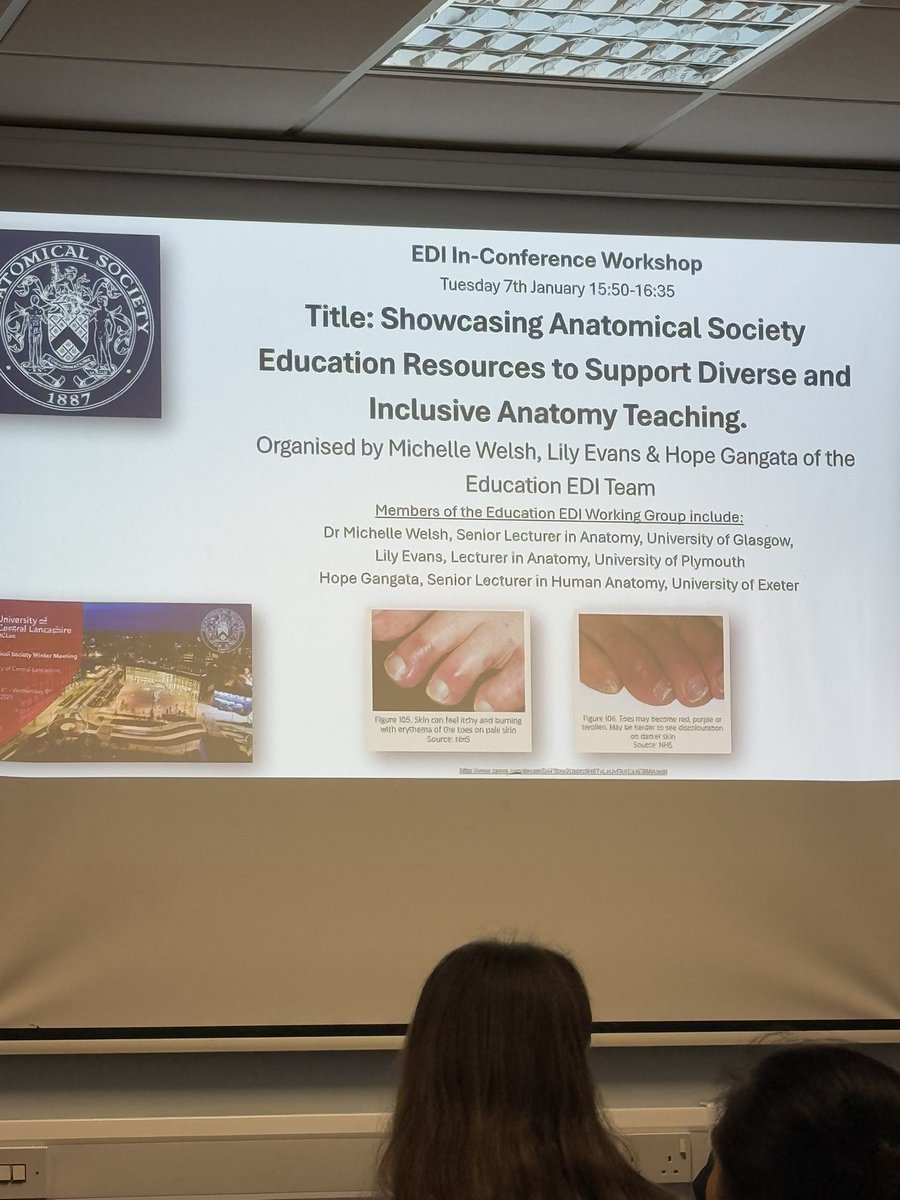 Very engaging workshop - really appreciated discussing ideas across different educators. Thank you for sharing your insights on incorporating EDI into Skin, Cardiovascular and Reproductive Anatomy  <a href="/lilyaevans1/">Lily Evans</a> <a href="/mwelshUoG/">Michelle Welsh</a> and Hope Gangta 
#AnatSocWinter24 #AnatSocUCLan