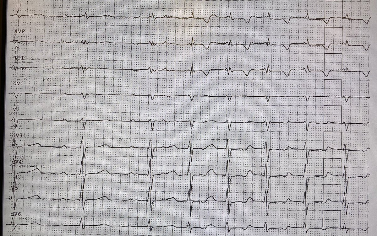 What is going on in this tracing?