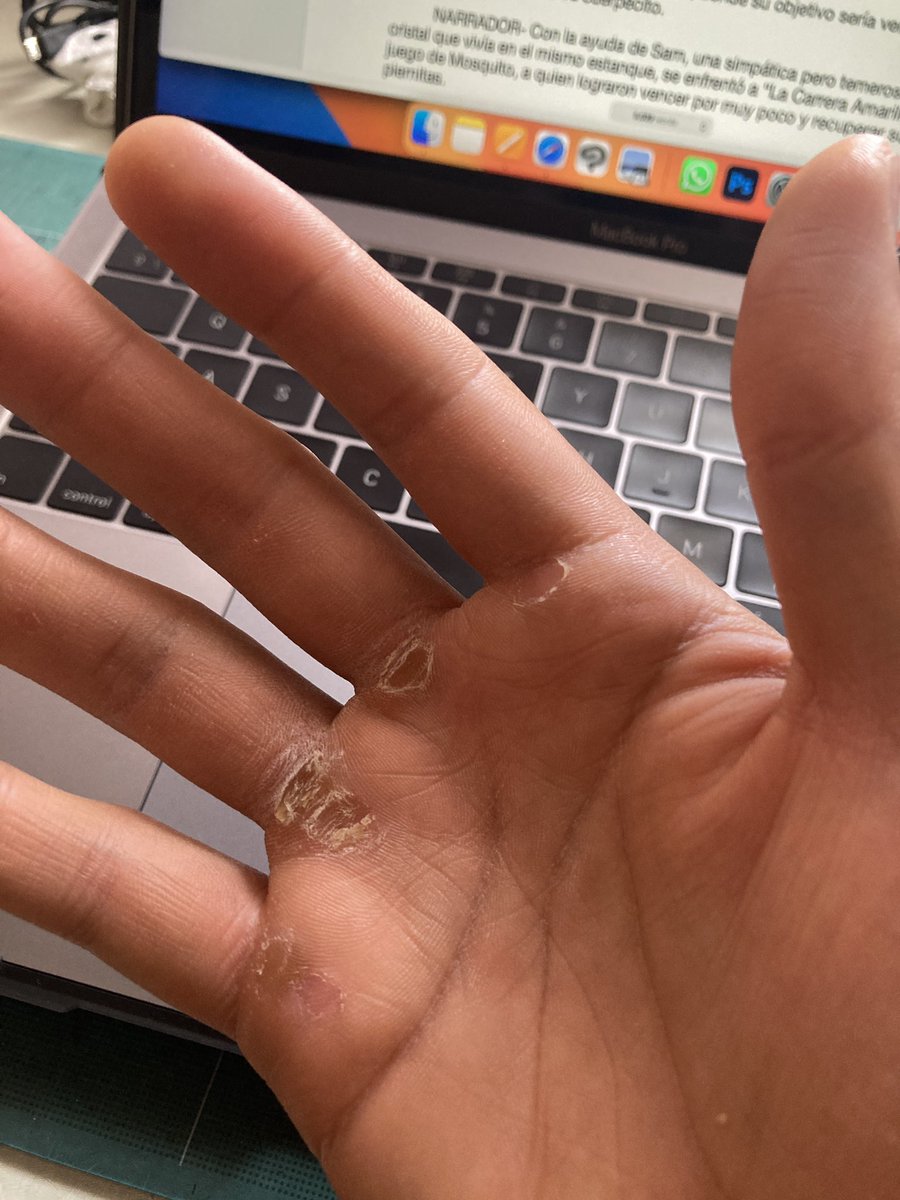 Estoy viviendo un contraste muy interesante en mi vida. Por un lado estoy escribiendo 2 guiones para mis próximas novelas gráficas.

Y por el otro estoy entrenando mi cuerpo para una competencia de Calistenia en Julio. 

Mi yo de hace 5 años jamás lo habría imaginado. Y me gusta.