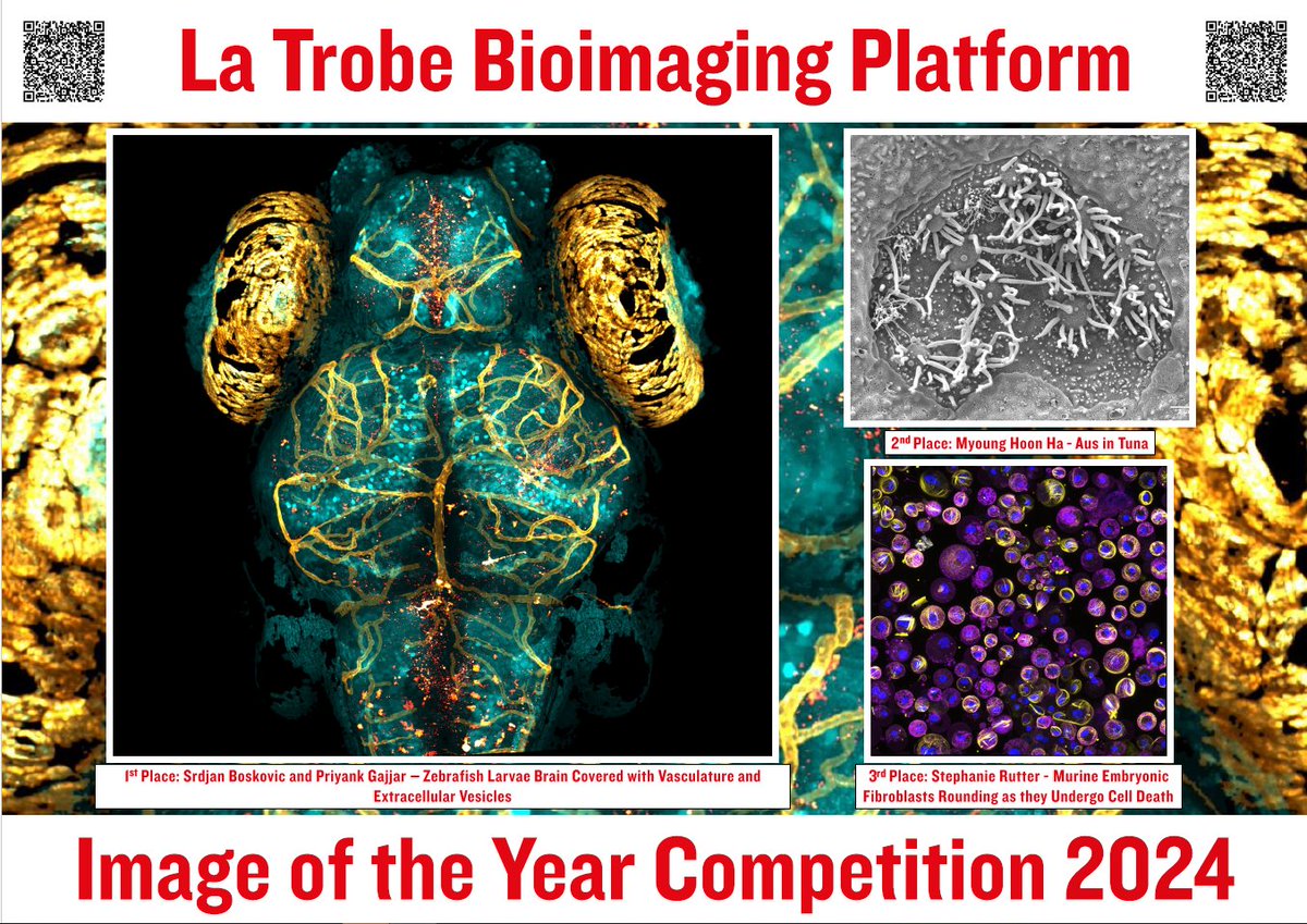 LaTrobeBIP's tweet image. Thank you to everyone who entered the @LaTrobeBIP imaging competition. Another great turnout showcasing the incredible work produced by @latrobe researchers. Congrats to first place winners Srdjan and Pri for their amazing zebrafish image. Hoon and Steph were our runners up.