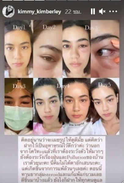 โห สมัยนี้ฝุ่นหายไปหมด คนก็หายหมด ดีๆๆๆๆๆ 😎😏