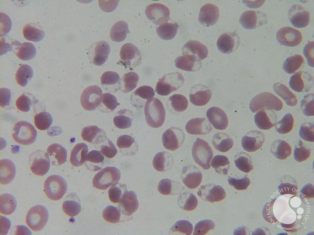 nihardesai89's tweet image. Hey #MedStudentTwitter 👋🏼

Do you know what this image shows?

Obviously you do !!

If not, read this short thread 👇🏻

#MedTwitter

1/6