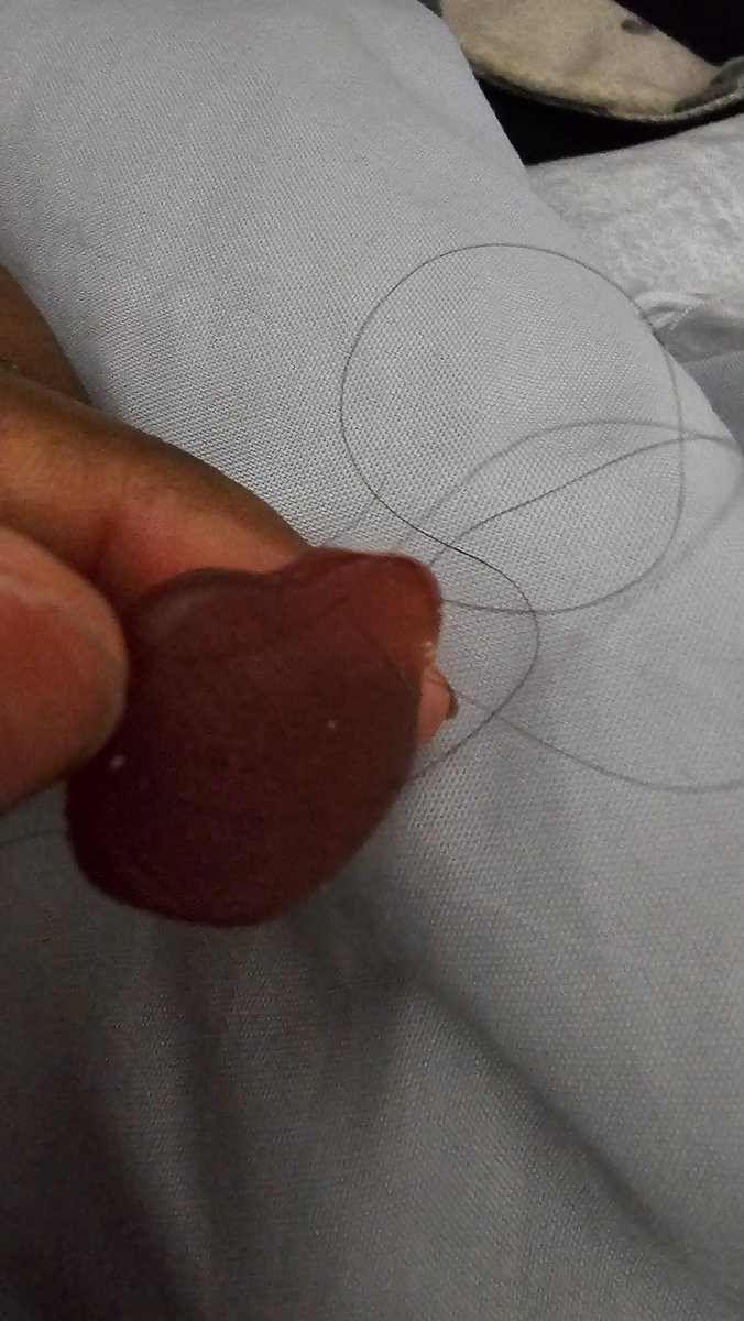AllSmilesSierra's tweet photo. @Motts I was eating my little cousins fruit snacks and found this in one of the packages 🤢🤢🤮🤮 https://t.co/NSvNkk8QHT