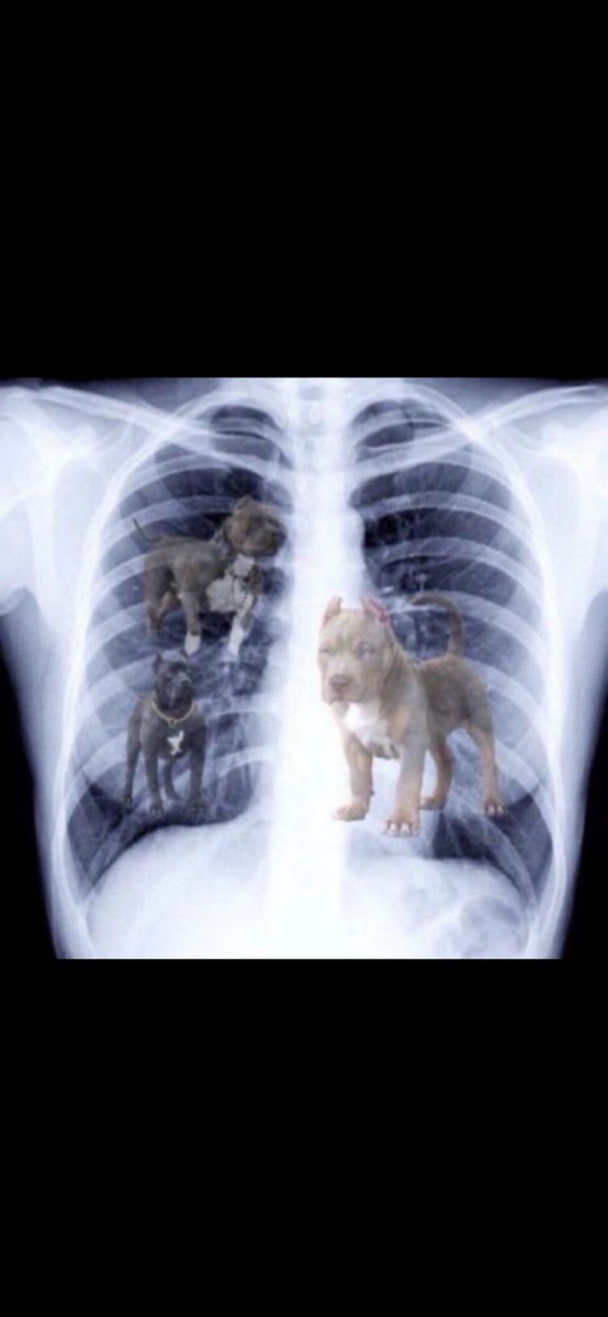 Chase and Stew X-Rays results just came in