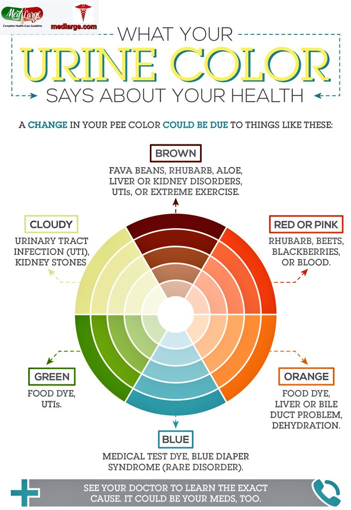medlarge's tweet image. Ever noticed the color of your pee? 💡 It might be telling you more about your health than you think! From hydration levels to potential health issues, learn what those shades mean before you flush. 🚰💛 #HealthTips #KnowYourBody 
#lockdown #BiggBoss18 #earthquake