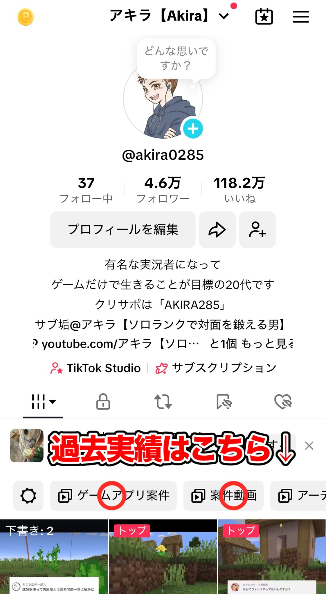 アキラ/Akira【ソロでアンリアル目指してます】 (@_Akira285) / X