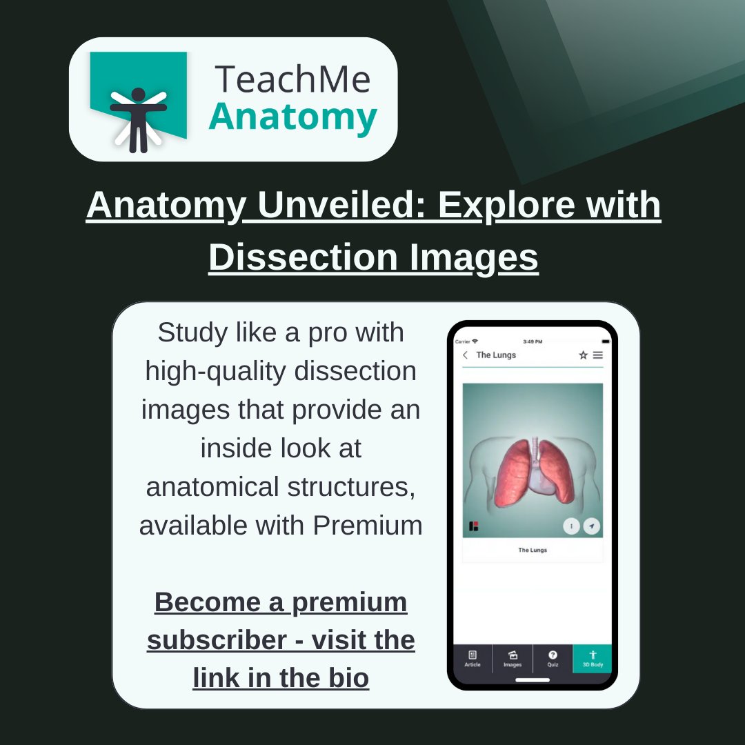 TeachMe_Support's tweet image. Explore with  dissection images and supercharge your anatomy learning with TeachMeAnatomy Premium 🚀

Find out more: teachmeanatomy.info/sign-up/ #medicalstudent #medicine #medstudent #medicalschool #medschool #physician #futuredoctor #premed #studymotivation #medlife #surgery
