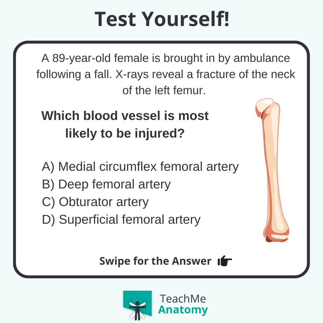 TeachMe_Support's tweet image. Test your clinical knowledge!🏆 Which blood vessel is most likely to be injured? #quiztime #QuizoftheWeek  #quizoftheday #meded #medschool #medicalstudent #medstudent #premed #premedlife #nursing #nursingschool #pastudent #physician #futuredoctor #premed #studymotivation #medlife