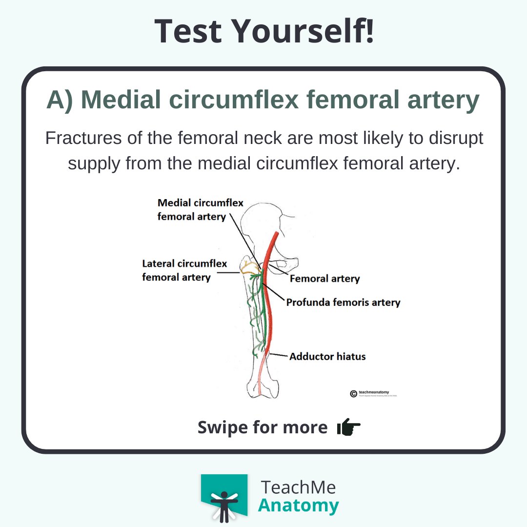TeachMe_Support's tweet image. Test your clinical knowledge!🏆 Which blood vessel is most likely to be injured? #quiztime #QuizoftheWeek  #quizoftheday #meded #medschool #medicalstudent #medstudent #premed #premedlife #nursing #nursingschool #pastudent #physician #futuredoctor #premed #studymotivation #medlife