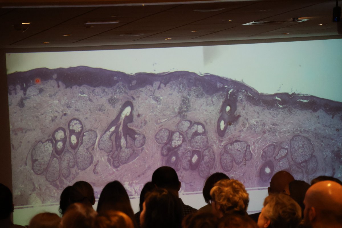 🎉The very first ESP Educational activity for 2025 is now on!
We are in Bordeaux, 🇫🇷 for an #EScoP #course in dermatopathology! 
We are welcoming 130 participants from 30 countries!

The first Tutor for this course is <a href="/V_Damaskou/">Vasileia (Vicky)Damaskou</a>!

#PathTwitter #PathX #pathology