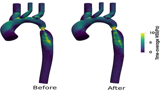 😃New article published in J Biomech!

"Growth in a two-dimensional model of coarctation of the aorta: A CFD-informed agent based model", by Hampwaye et al.

👀sciencedirect.com/science/articl…

#journalofbiomechanics
#BiomechSky