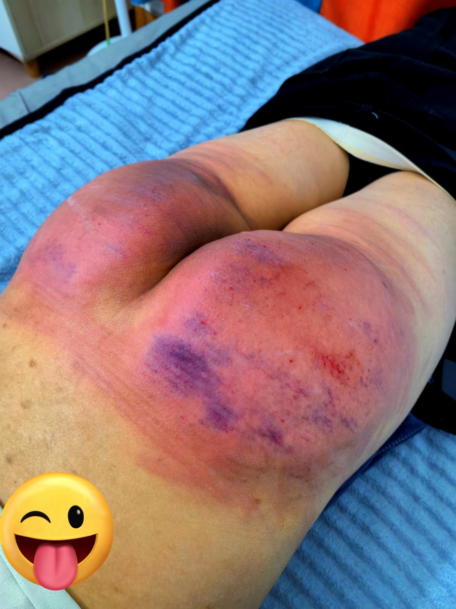 【表哥小趴菜之管教小墨减肥】 不敢皮了……
<a href="/outever3/">S积木sp</a>