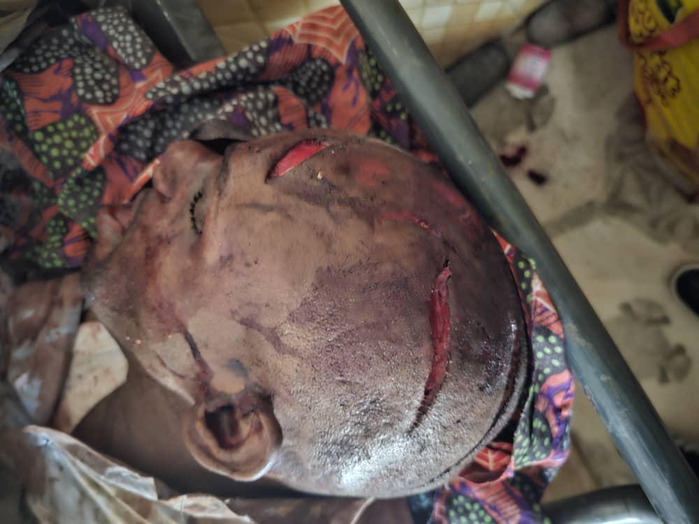 akimjoach's tweet photo. @wembi_steve @amnesty Est-ce que vous savez qu'il y a un journaliste qui était sauvagement tué dans la nuit du Mardi 7 au 08/01/2025 à plusieurs coups de machette ! Nous avons des images et vous n'allez pas aimer les revoir. https://t.co/ydMt9SplfH