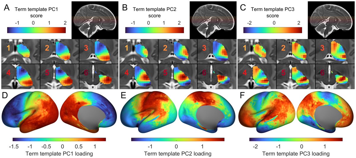 New paper in Imaging Neuroscience by Stuart Oldham, Sina Mansour L., and Gareth Ball:

Perinatal development of structural thalamocortical connectivity

direct.mit.edu/imag/article/d…