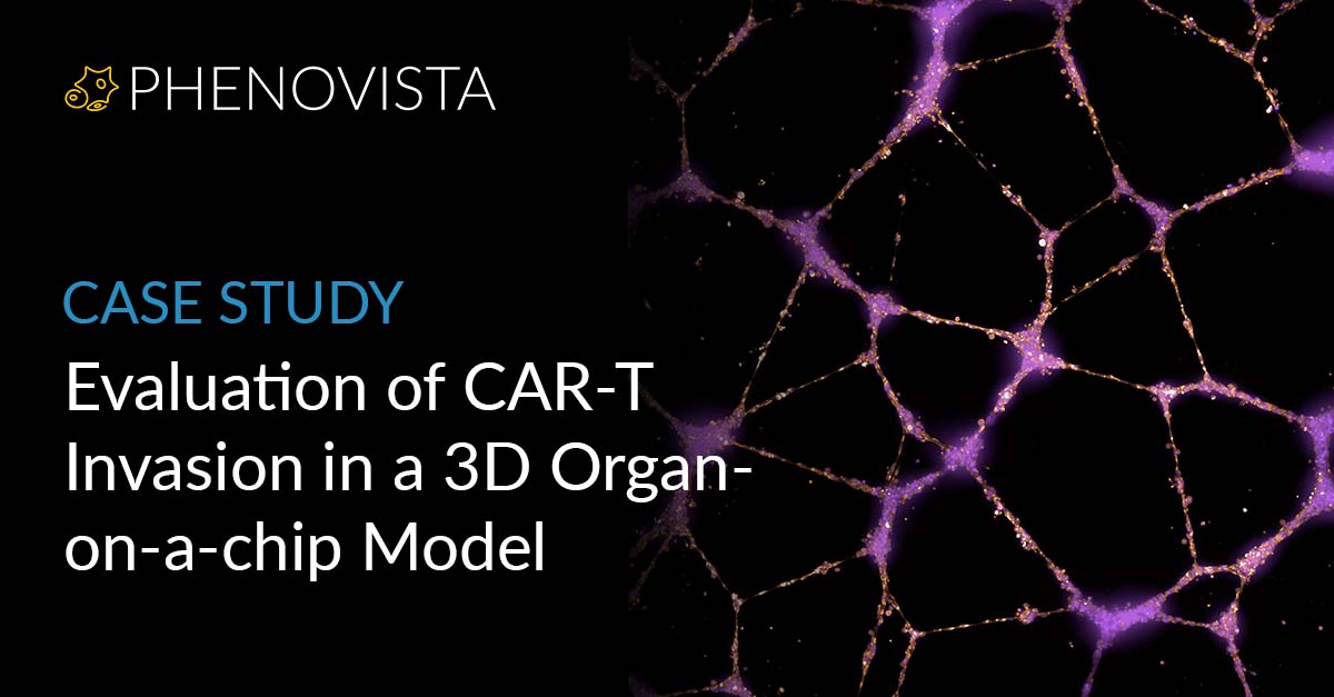 NEW CASE-STUDY ALERT! 

And this one covers a lot of buzzwords: Organ-on-chip, immuno-oncology, CAR-T, co-culture, and (our favorite as scientists with high standards) quality control!  

Download your own copy of this case study here: hubs.ly/Q033pZXs0