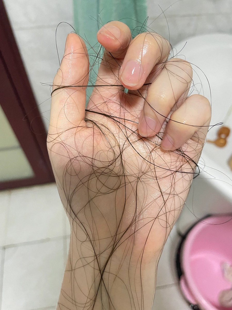 Adeline_dssh's tweet image. 何が起こったの？髪の毛がすごく抜けたの。