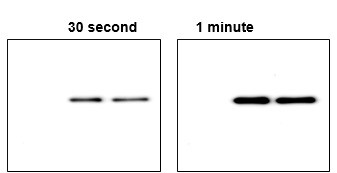 📣 New Agrisera SUMO tag available!

Using a SUMO tag offers many advantages and uses, including increased protein expression and solubility, two-step affinity purification and identify binding partners in pull-down assays.

Read more: eu1.hubs.ly/H0f_CpH0