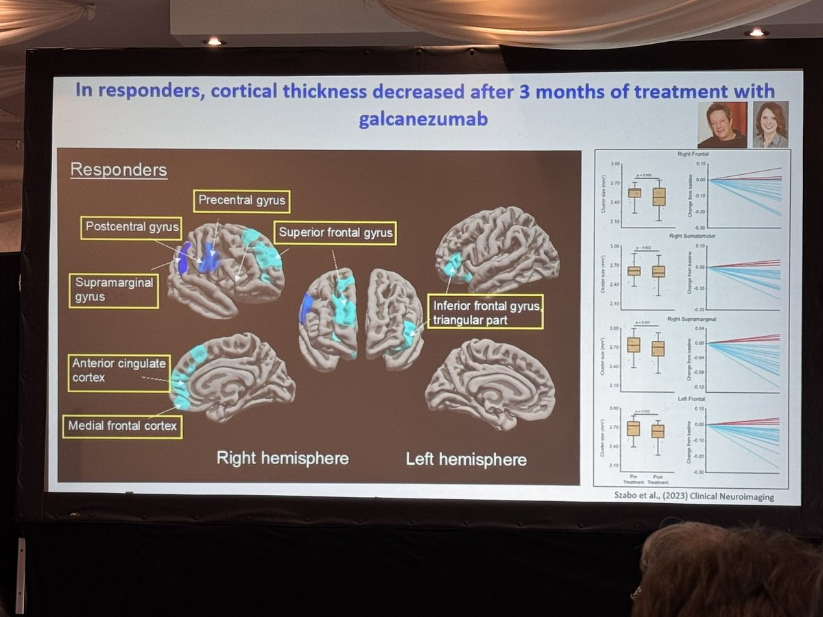 . <a href="/ramiburstein/">Dr. Rami Burstein</a> shows cortical morphological change in #chronicmigraine #migraine with reversal of change in responders to monoclonal antibody therapy