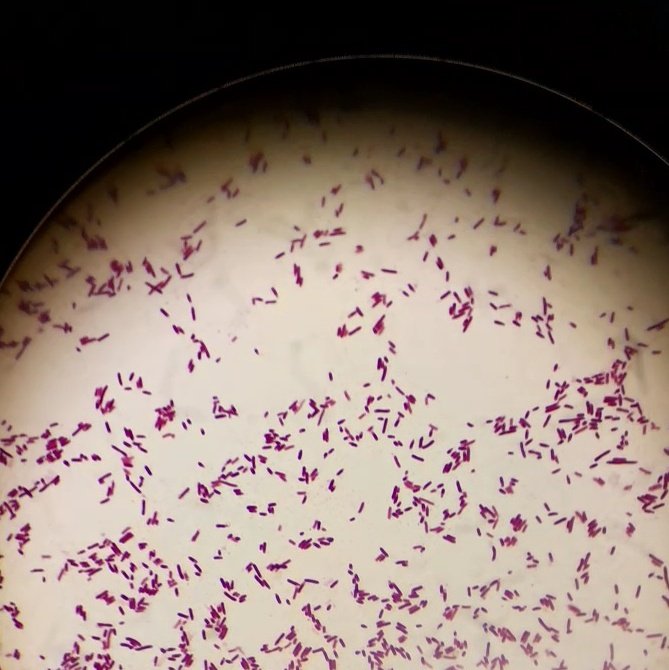 mariestdy's tweet photo. 21/1/25
menuntaskan bakteriologi 🔬🤍🖇 https://t.co/3LQcjau0Jx