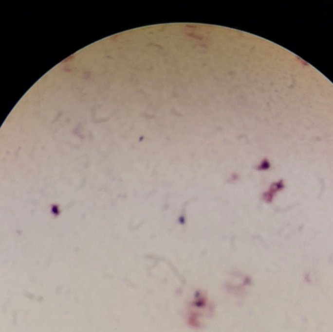 mariestdy's tweet photo. 21/1/25
menuntaskan bakteriologi 🔬🤍🖇 https://t.co/3LQcjau0Jx