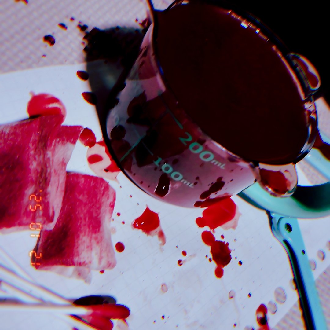 瀉血は200mlで終わりー
_( _´  -`  )_…