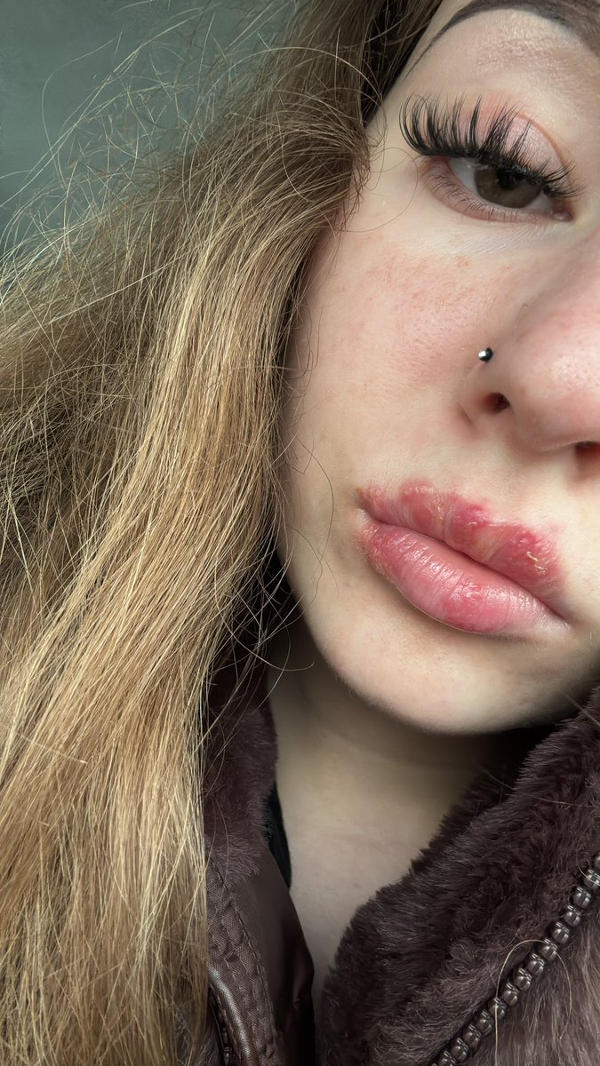 nikomu nepreju trpet na opary, jeste vecer nic a rano jsem se vzbudila s timhle