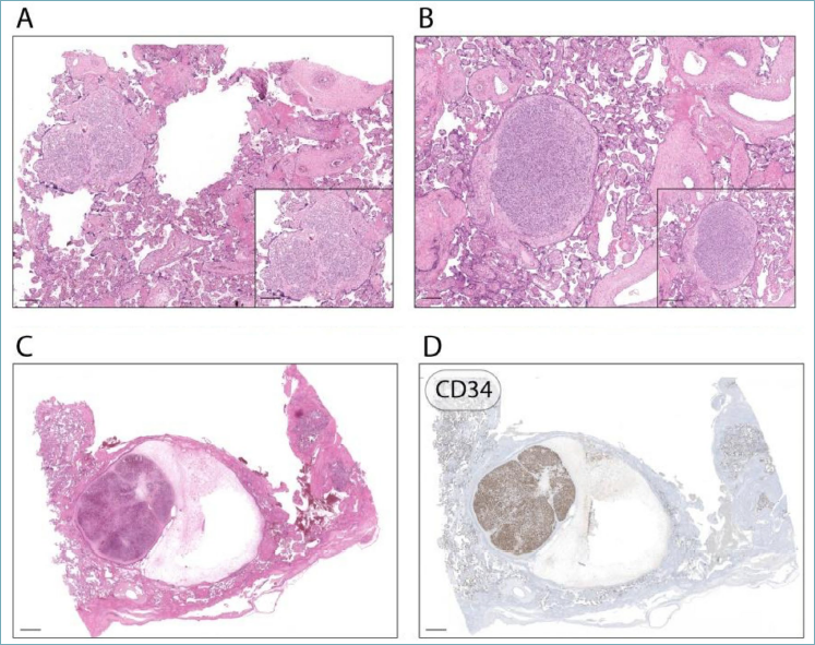 Pathologica tweet media