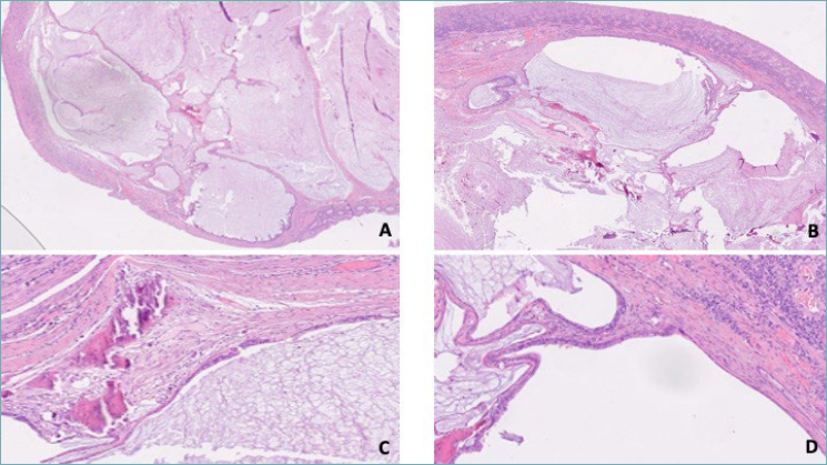 Pathologica tweet media