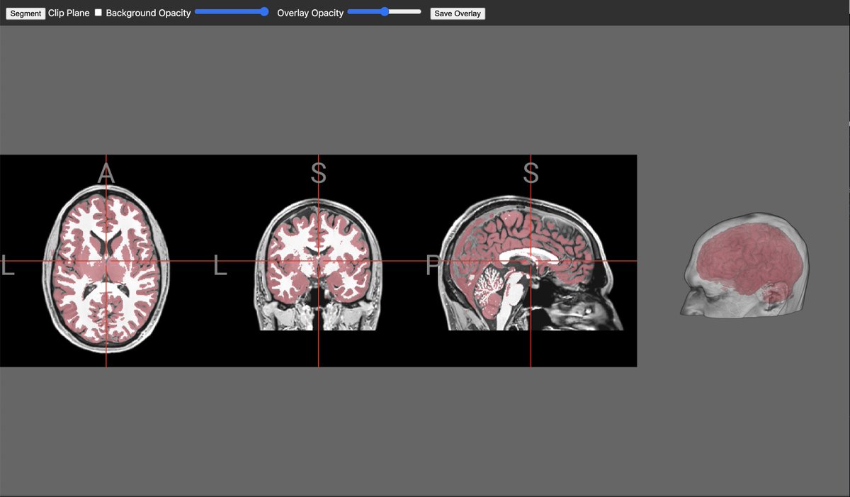 wpmed92's tweet image. A cool lil project I'm tackling: tinygrad WebGPU performing brain segmentation in a browser. #tinygrad #webgpu
Visualization by niivue.
PR: github.com/neurolabusc/ni…
Checkout github.com/tinygrad/tinyg… that performs the model export.