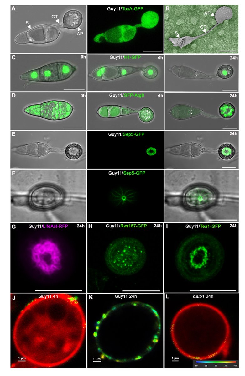 JournalofMicroscopy (@jofmicroscopy) on Twitter photo We’ve just published a new review we think you’ll find interesting "Live cell imaging of plant infection provides new insight into the biology of pathogenesis by the rice blast fungus Magnaporthe oryzae" by <a href="/bear_laine/">Berlaine Quime</a>, <a href="/Ryder_Lauren1/">Lauren Ryder</a> & <a href="/talbotlabTSL/">Nick Talbot</a>.
onlinelibrary.wiley.com/doi/10.1111/jm… We’ve just published a new review we think you’ll find interesting "Live cell imaging of plant infection provides new insight into the biology of pathogenesis by the rice blast fungus Magnaporthe oryzae" by <a href="/bear_laine/">Berlaine Quime</a>, <a href="/Ryder_Lauren1/">Lauren Ryder</a> & <a href="/talbotlabTSL/">Nick Talbot</a>.
onlinelibrary.wiley.com/doi/10.1111/jm…