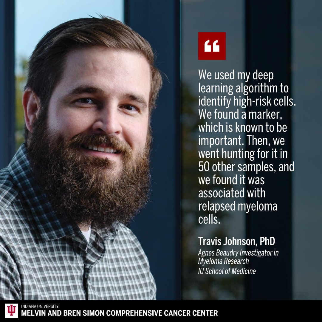 IU Simon Comprehensive Cancer Center (@iucancercenter) on Twitter photo The cancer center's Travis Johnson, PhD, and Brian Walker, PhD, found that patients with an extra copy of a chromosome have elevated levels of a protein that fuels myeloma’s recurrence. Learn more: ow.ly/etw850UCQ5s. #ResearchCuresCancer <a href="/IUImpact/">Indiana University Research</a> <a href="/IUMedSchool/">IU School of Medicine</a> The cancer center's Travis Johnson, PhD, and Brian Walker, PhD, found that patients with an extra copy of a chromosome have elevated levels of a protein that fuels myeloma’s recurrence. Learn more: ow.ly/etw850UCQ5s. #ResearchCuresCancer <a href="/IUImpact/">Indiana University Research</a> <a href="/IUMedSchool/">IU School of Medicine</a>