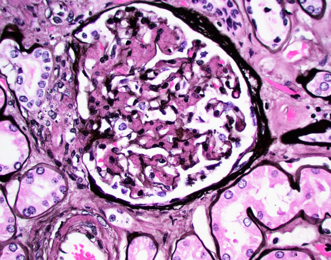 Jonathan Zuckerman MD PhD tweet media