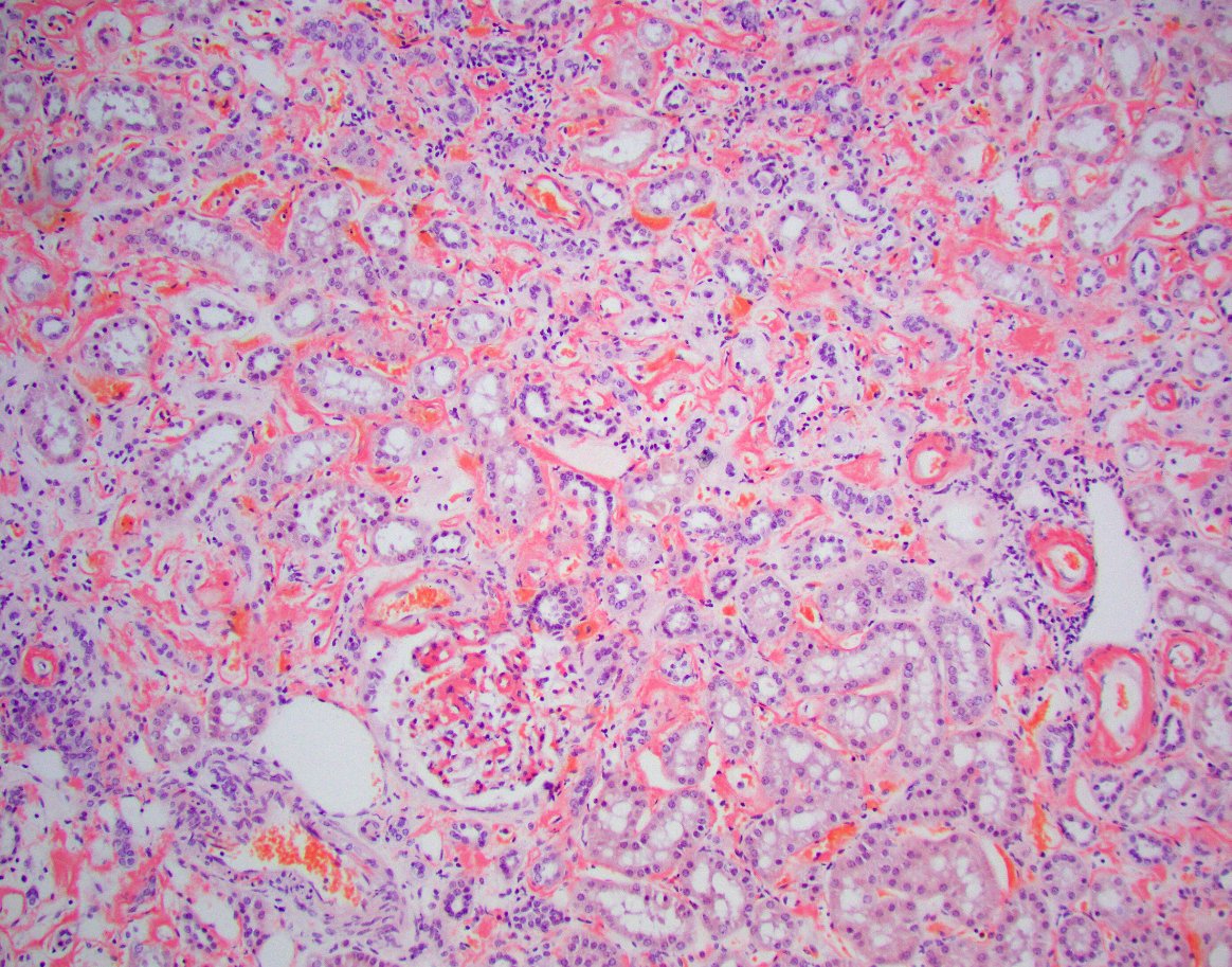 Jonathan Zuckerman MD PhD tweet media