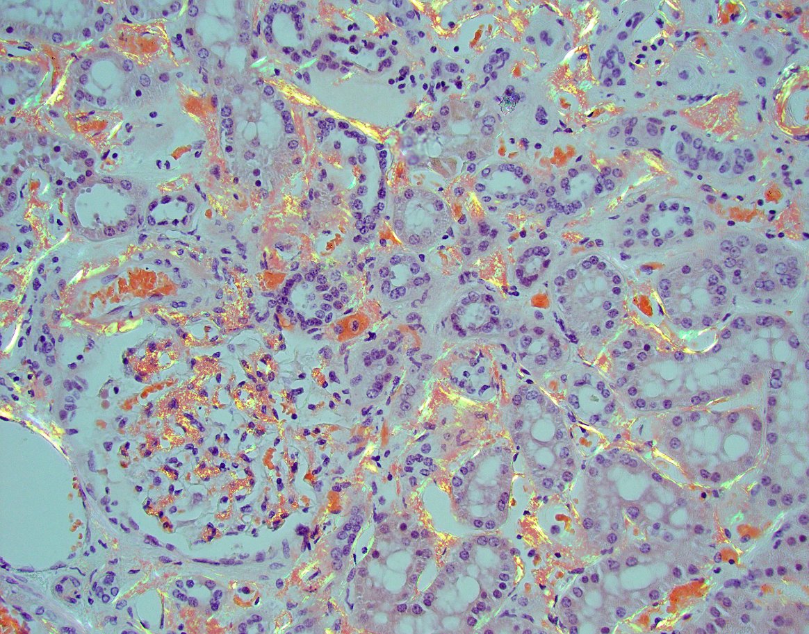 Jonathan Zuckerman MD PhD tweet media