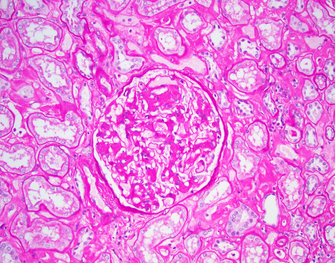 Jonathan Zuckerman MD PhD tweet media