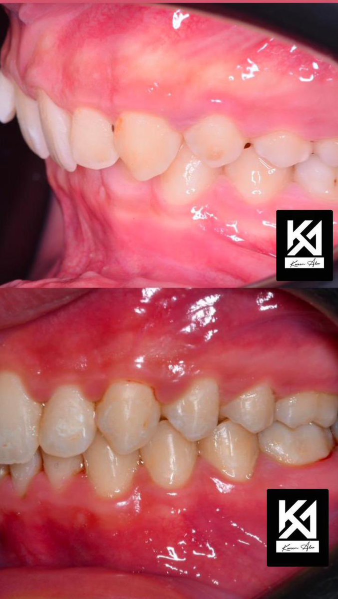 Welcome back to twitter ❤️✊.