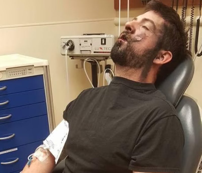 andrew hall e cigarette In 2017, an Idaho man, Andrew Hall, suffered severe injuries when an e- cigarette exploded in his mouth, burning his skin and knocking out seven  teeth. Rushed to intensive care, doctors removed plastic