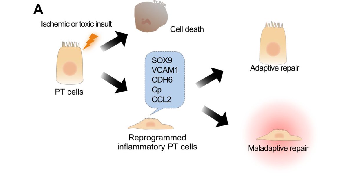 AJPRenal's tweet photo. From the minds at @DukeMedSchool, here come's today's #ArticleinPress, the #EditorialFocus Pax Inhibition: Stressing Proximal Tubule for Successful Repair (Hiroki Kitai et al.):
https://t.co/YQrD1xaJr7
#Cells #Kidney https://t.co/e6RzzcPjEW