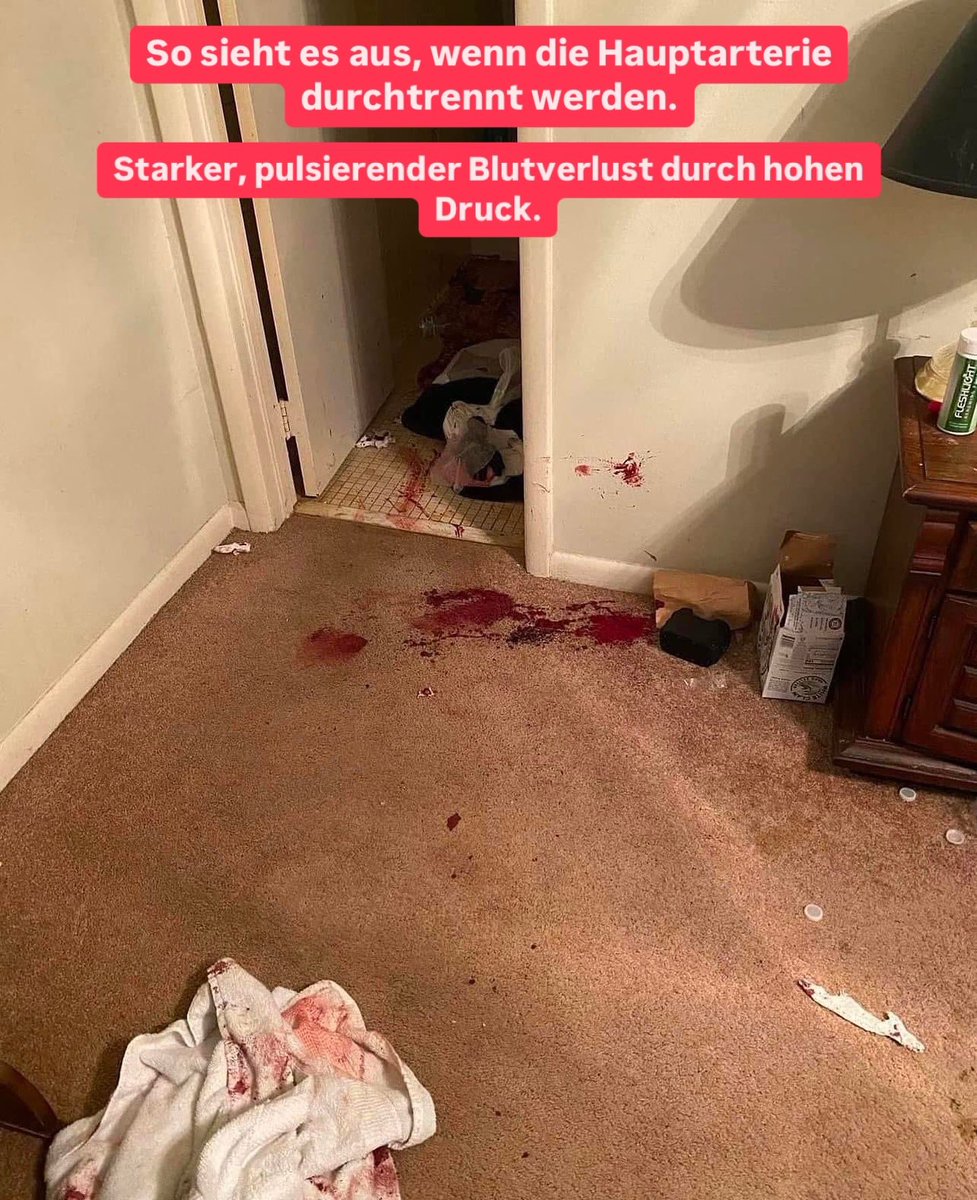anatomie_pro's tweet photo. Starker, pulsierender Blutverlust durch hohen Druck. https://t.co/YqnrRrhjw8